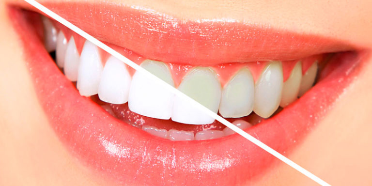 estetica-dental-768×384